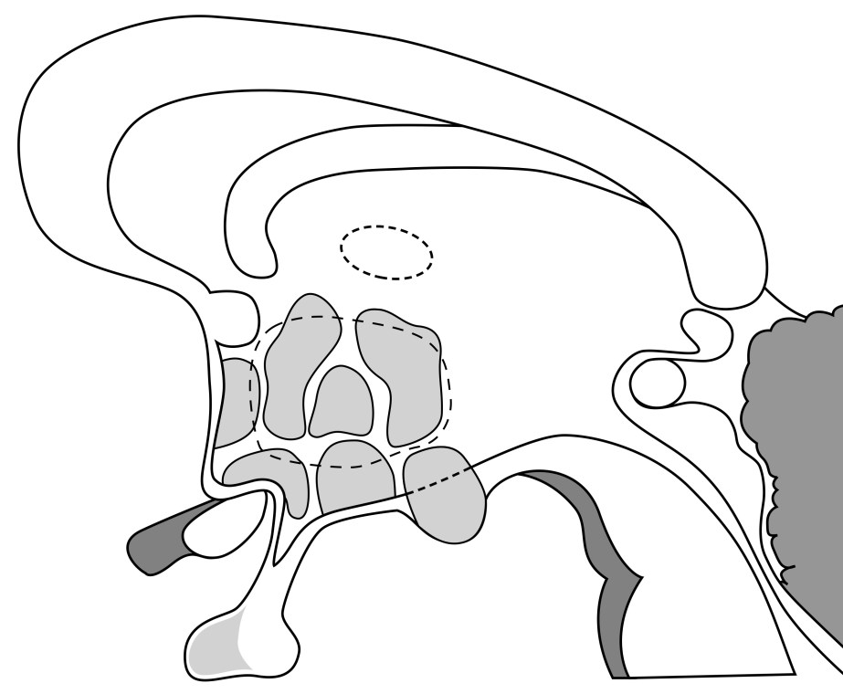 Hypothalamic Nuclei